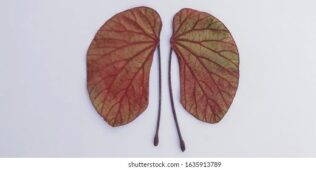 Ödem sorunu ile ilgili olarak böbrek hastalıklarına dair, fotoğrafta böbrek şekilli yapraklar